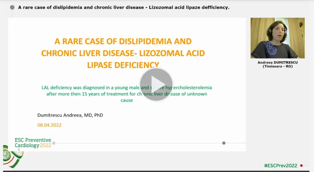 A rare case of dislipidemia and chronic liver disease Lizozomal acid lipaze defficiency.png x